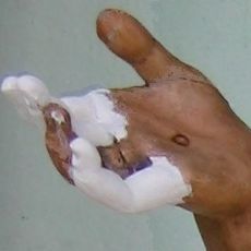 Hand vor Restauration